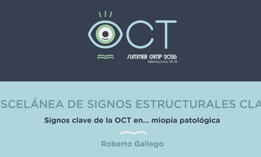Clase 34 - Signos clave de la OCT en… miopía patológica